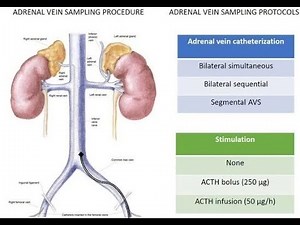 Adrenal Vein Sampling ; Definition, Diagnostic Procedure, Uses