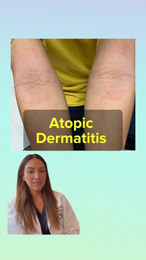 the_allergy_doc on TikTok