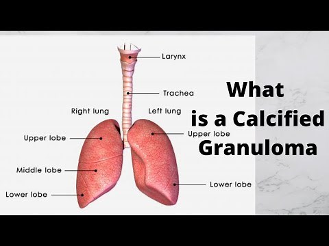 What is a Calcified Granuloma