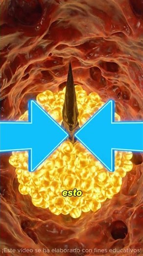 How do you remove the splinters? 😲