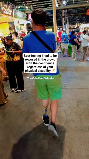 #fbfypシ #foryoupageviralシ゚ #proudpwd #physicaldisability #awareness #viralpage #fypシ゚ | Ton Caballero Vlogz