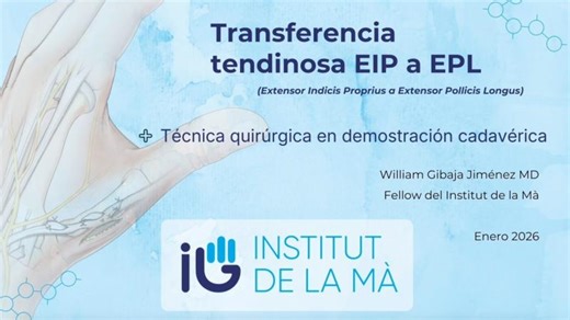 TRANSFERENCIA EIP ➜ EPL 🔥 | Recupera la EXTENSIÓN del PULGAR (Paso a paso) | Dr. W. Gibaja 🇵🇪 | Dr. Sergi Barrera-Ochoa