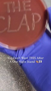 27K views · 756 reactions | The Clap is clapping cheeks in...