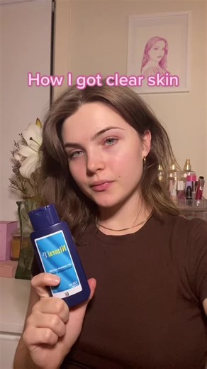 Transform Your Skin with Nizoral Shampoo: My Skincare Journey