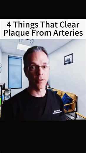 How to Reduce Artery Plaque Naturally: 4 Evidence-Based Steps
