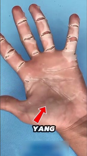 This is the cause of peeling skin‼️