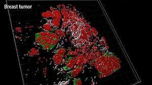 54K views · 406 reactions | 3D tumor maps give researchers an unprecedented look at cancer growth. Learn more: https://scim.ag/3RmHkuD | Science | Facebook