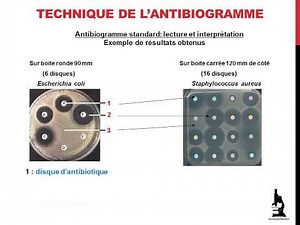 Antibiogramme : notions de base