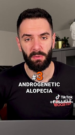 Understanding Different Types of Hair Loss: Causes and Treatments