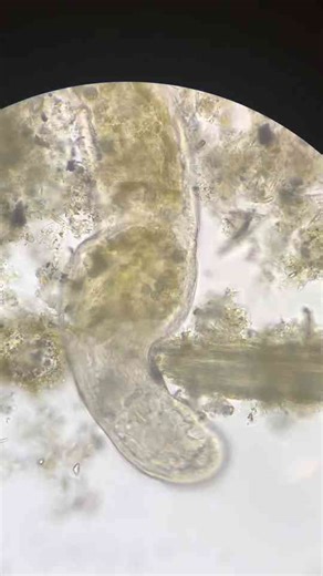 The Fascinating World Under a Microscope Lens