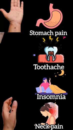 767K views · 2.7K reactions | Acupressure points for relief from Stomach pain Toothache Insomnia Neck pain #yogaforall #yogaheals #acupressure #trending | panchbhootyog | Facebook