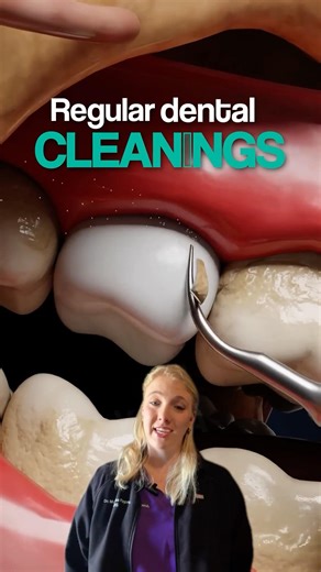 Regular dental cleanings save you money?