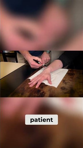 Crafting a Custom Splint: Hand Anatomy to Molded Fit #handspecialist #carpaltunnelrelief