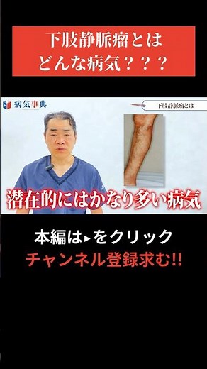 【下肢静脈瘤とは？】どんな病気か正しく理解してますか?!?!【現役医師が解説】#下肢静脈瘤 #病気解説 #こむら返り #足ボコボコ