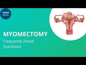 Myomectomy- Frequently Asked Questions