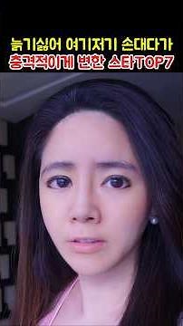 늙기싫어 여기저기 손대다가 충격적이게 변한 스타 TOP7
