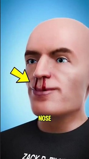 Why Does Your Nose Suddenly Start Bleeding for No Reason?