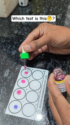 widal test Kya hota Hai #typhoid test #shorts #motivation #shortvideo