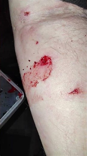 xylaxine #experiment #science ‪@James-x6e9l‬