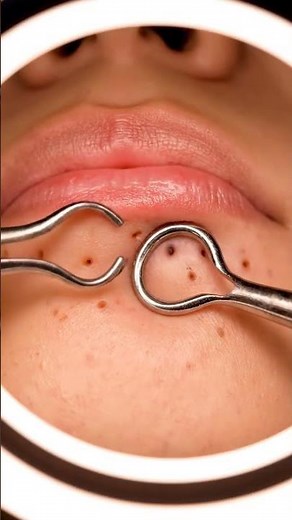 Relax Every Day, Spa Facial Treatment, Blackhead Extraction, Removal,ASMR, Relaxing Spa#1