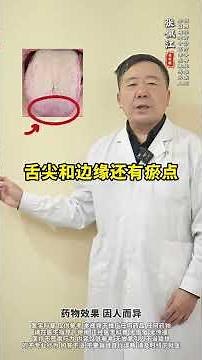 舌苔厚腻者的黄金四步法，15天再厚腻的舌苔也扒干净,健康养生,中医药