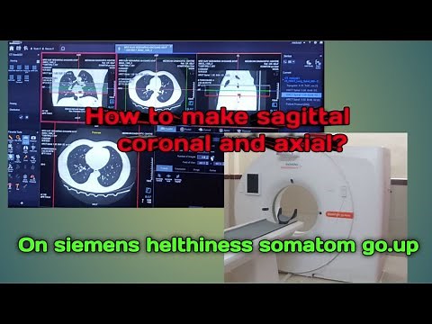 How to perform sagital coronal and axial on siemens helthiness somatom go.up #siemensct.
