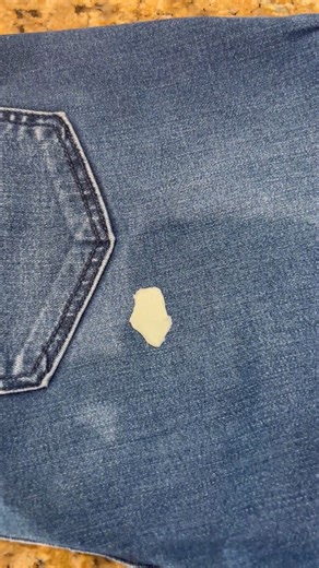 Easy Gum Removal RJS, NM LLC | Rebecca JS