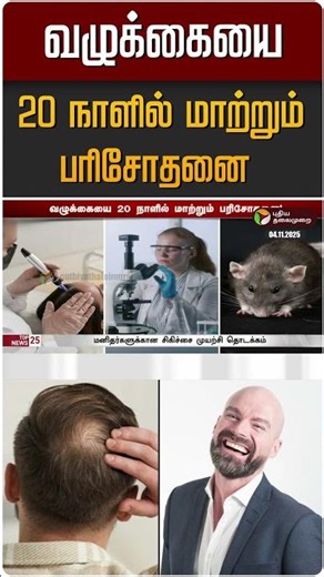 வழுக்கையை 20 நாளில் மாற்றும் பரிசோதனை | Baldness