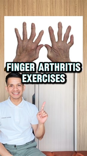 313K views · 4.5K reactions | FINGER ARTHRITIS EXERCISES 殺殺殺 | Physical Therapy Session | Facebook