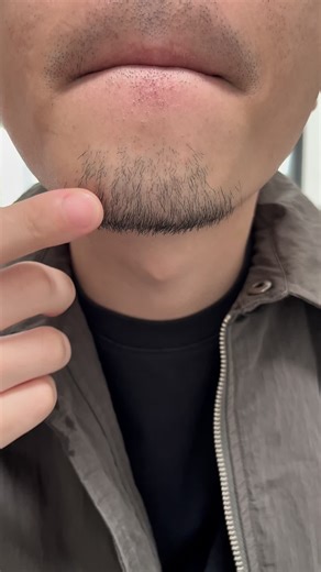 Beard Growth Success: Tips and Transformation