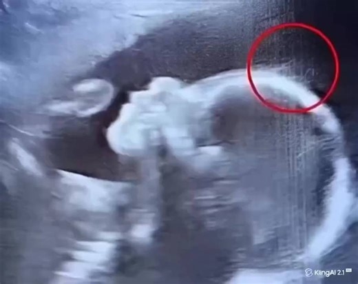 4.1K views | "The doctors were left speechless when they saw the ultrasound — and this baby girl captured everyone’s hearts from the very moment she was born 勺✨ When the 29-year-old woman..." more in comment   | Classic Cartoons | Facebook