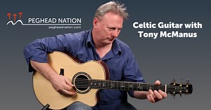 Celtic Guitar | Peghead Nation