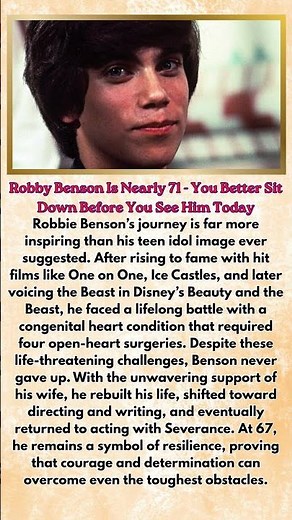 Robby Benson Is Nearly 71 - You Better Sit Down Before You See Him Today