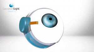 Neuralink and the Brain's Magical Future — Wait But Why