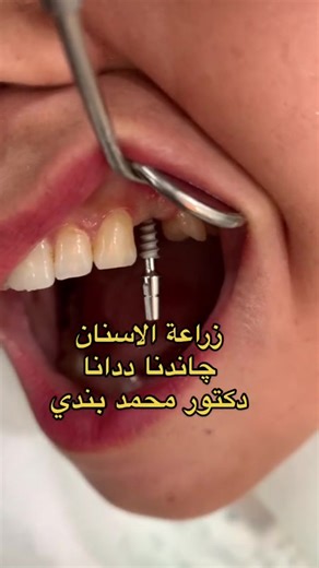 فيديوهات أنشأها Dr.Mohammed.Bandi (@dr.mohamed.bandi) باستخدام original sound - Dr.Mohammed.Bandi