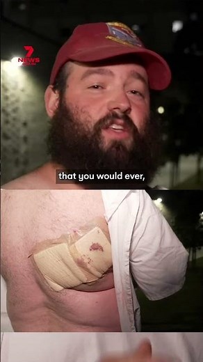 Victim speaks after being shot in back at Bondi Beach