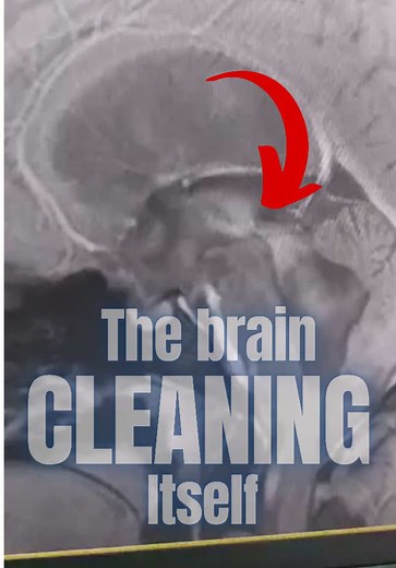 Understanding Cine MRI and Cerebrospinal Fluid Dynamics