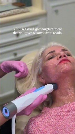 The XERF treatment delivers both long-lasting AND immediate skin tightening results.