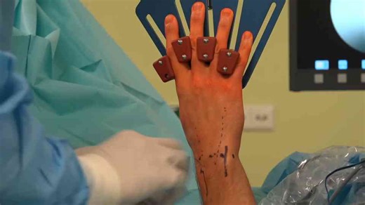 Carpal Tunnel Syndrome | Risks, Causes and Treatments