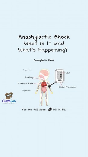 Anaphylactic Shock - What Is It and What's Happening? 🧐 #mastcell #ClevaLab #anaphylactic #anaphylacticshock #LearnOnTikTok #biologytok #sciencetok