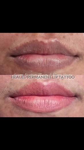 300K views · 529 reactions | DARKLIPS NO MORE. Say Goodbye to ur Dark pigmented lips and Say Hello to your new lip color . #PermanentLipTattoo by our very own #Artist Ms.Suzette Escalante . | Suzette Escalante Beautech Tattoo Studio | Facebook