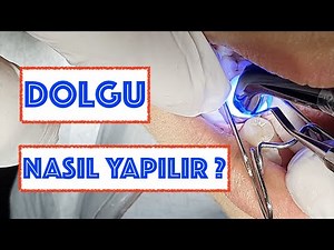 Dolgu Nasıl Yapılır ?