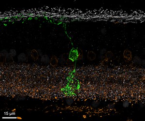 Researchers Discover New Type of Nerve Cell in the Retina