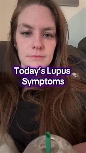 Understanding Today’s Lupus Symptoms and Their Impact