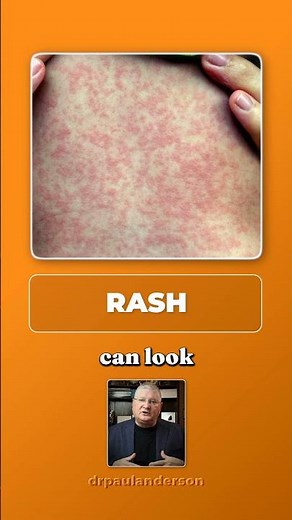 How to Tell If You’re Sensitive to Sulfites