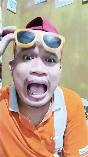 itchy bald man #funny #comedy #youtubeshorts #shorts