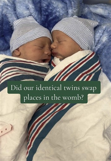 Such a crazy concept that I can’t seem to ever wrap my head around. #fypviral #fypシ゚viral #identicaltiwns #3under3 #fraternaltwins #sahm #twinsoftiktok #diditwins #monoditwins #fyp #twinpregnancy #csection #pregnantlife #viral #creatorsearchinsights #trending #identical #twintok
