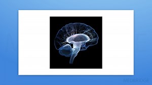 Neurologic Treatments Part 1: Neuroplasticity and Motor Learning | Medbridge