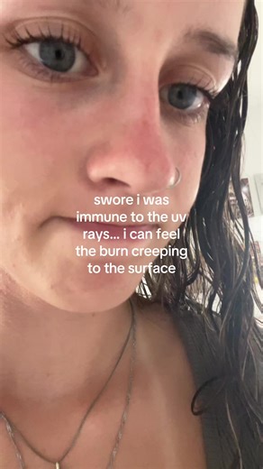 Understanding UV Ray Effects on Skin Health