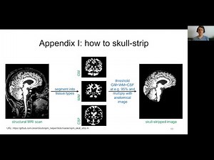 Appendix 1: "Addendum to Preprocessing" (Neuroimaging Lecture, SS 2023)